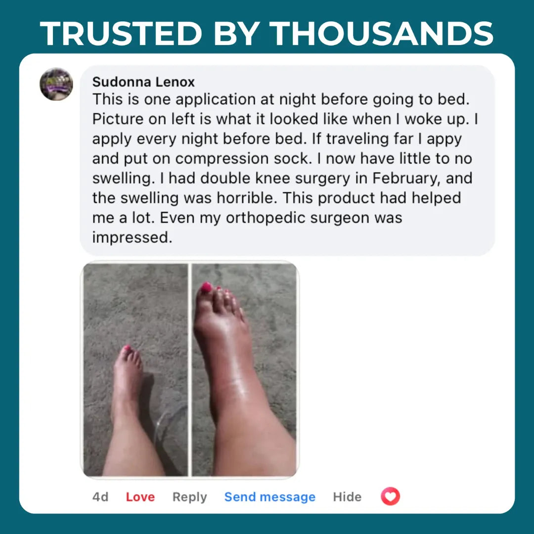 NuroBalm | Relieves swollen and heavy legs in just 14 days